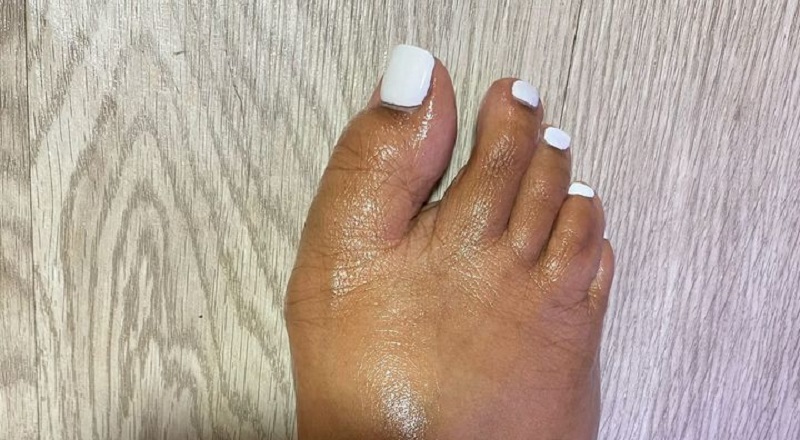 DeAndre Moore shared a photo to Facebook, of his girlfriend's toes. Jokingly, he shared this on Facebook, with her crooked toes. He said he got her toes done and wanted to know what the people thought, and the people in the Facebook comments did not hold back.